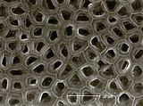 5 - Cellule epitalliche in visione superficiale